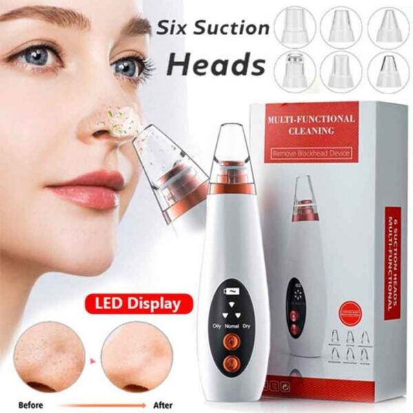 Blackhead Removal Machine – Deep Pore Cleaner